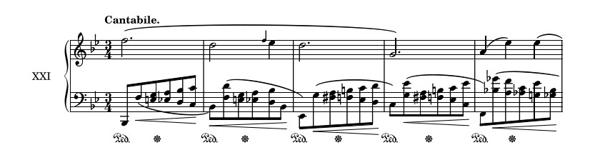 An excerpt of Chopin's Prélude Op. 28, No. 21